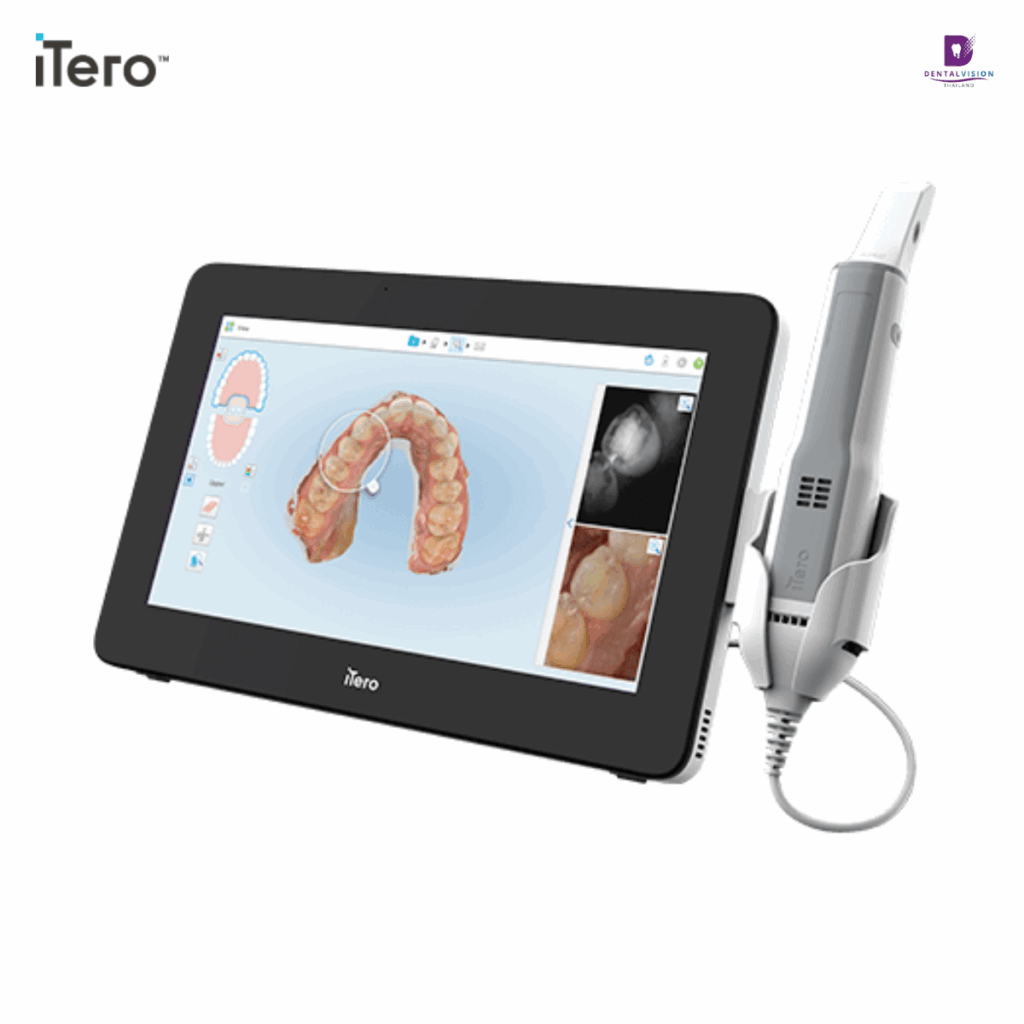 iTero Element 5D Plus Mobile Configuration