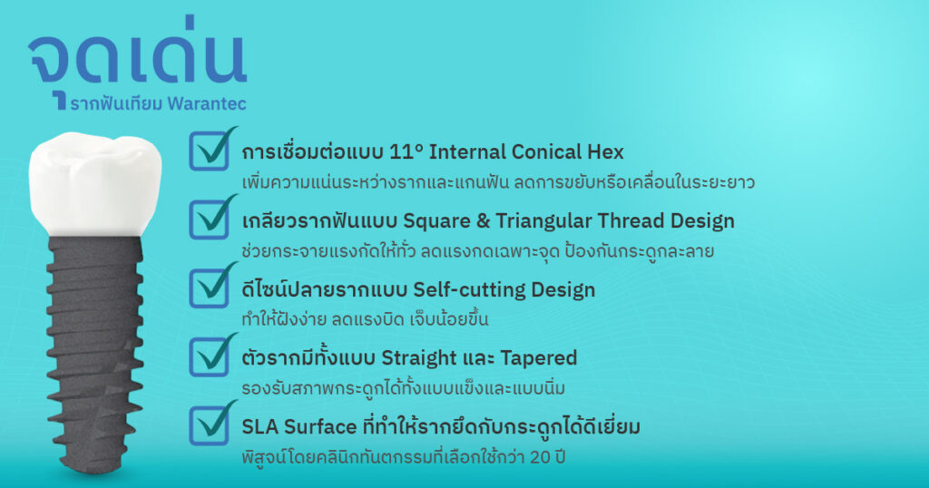 จุดเด่นของรากฟันเทียมเกาหลี Warantec