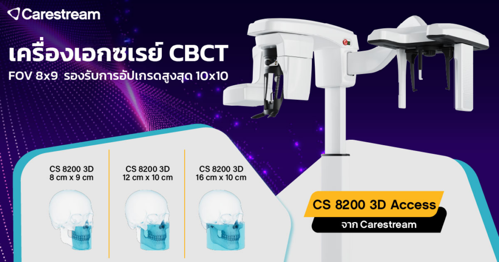 เทรนด์เครื่องเอกซเรย์ CBCT ปี 2026 ที่คลินิกทันตกรรมไม่ควรมองข้าม-4