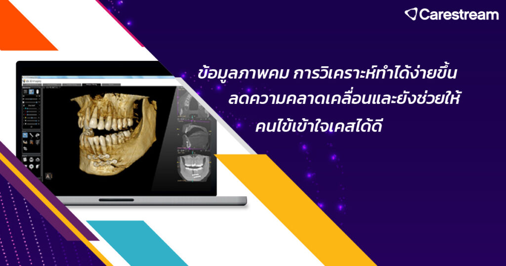 เทรนด์เครื่องเอกซเรย์ CBCT ปี 2026 ที่คลินิกทันตกรรมไม่ควรมองข้าม-2