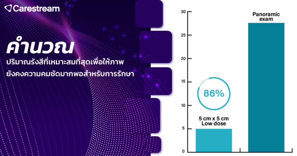 เทรนด์เครื่องเอกซเรย์ CBCT ปี 2026 ที่คลินิกทันตกรรมไม่ควรมองข้าม-3