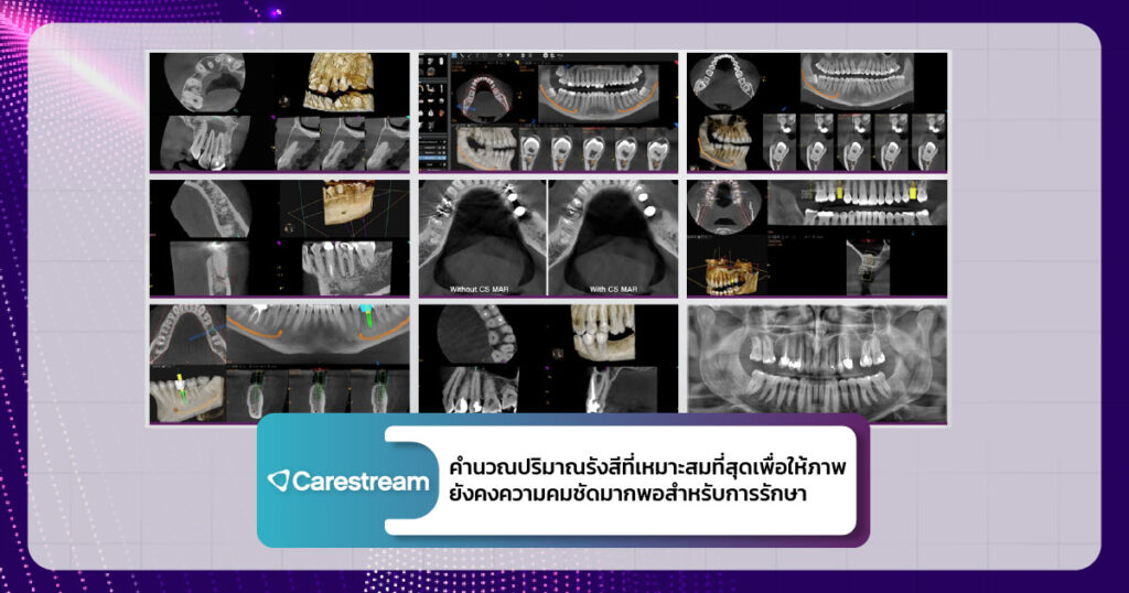 เทรนด์เครื่องเอกซเรย์ CBCT ปี 2026 ที่คลินิกทันตกรรมไม่ควรมองข้าม-5
