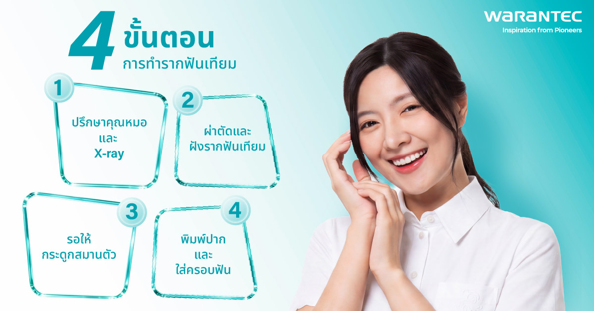 4 ขั้นตอนการทำรากฟันเทียม